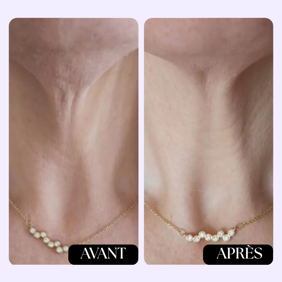 Crème de cou raffermissante et liftante