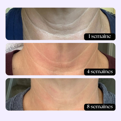 Crème de cou raffermissante et liftante