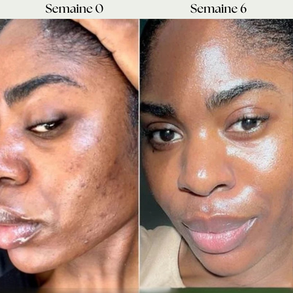 Masque de nuit au curcuma et à l'acide kojique