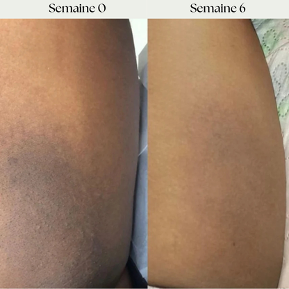 Masque de nuit au curcuma et à l'acide kojique